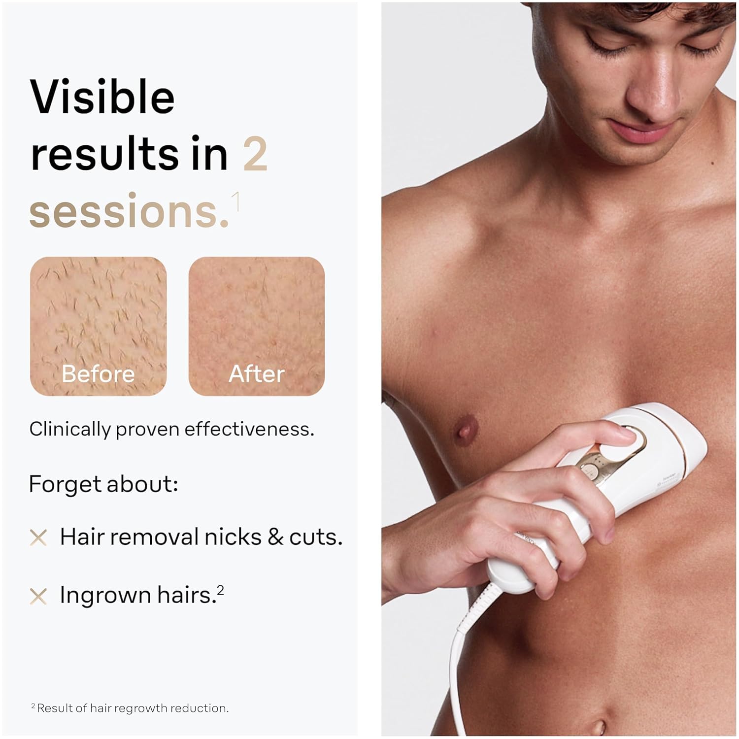 Lumora IPL Pro 5 – Long-Lasting Hair Removal at Home