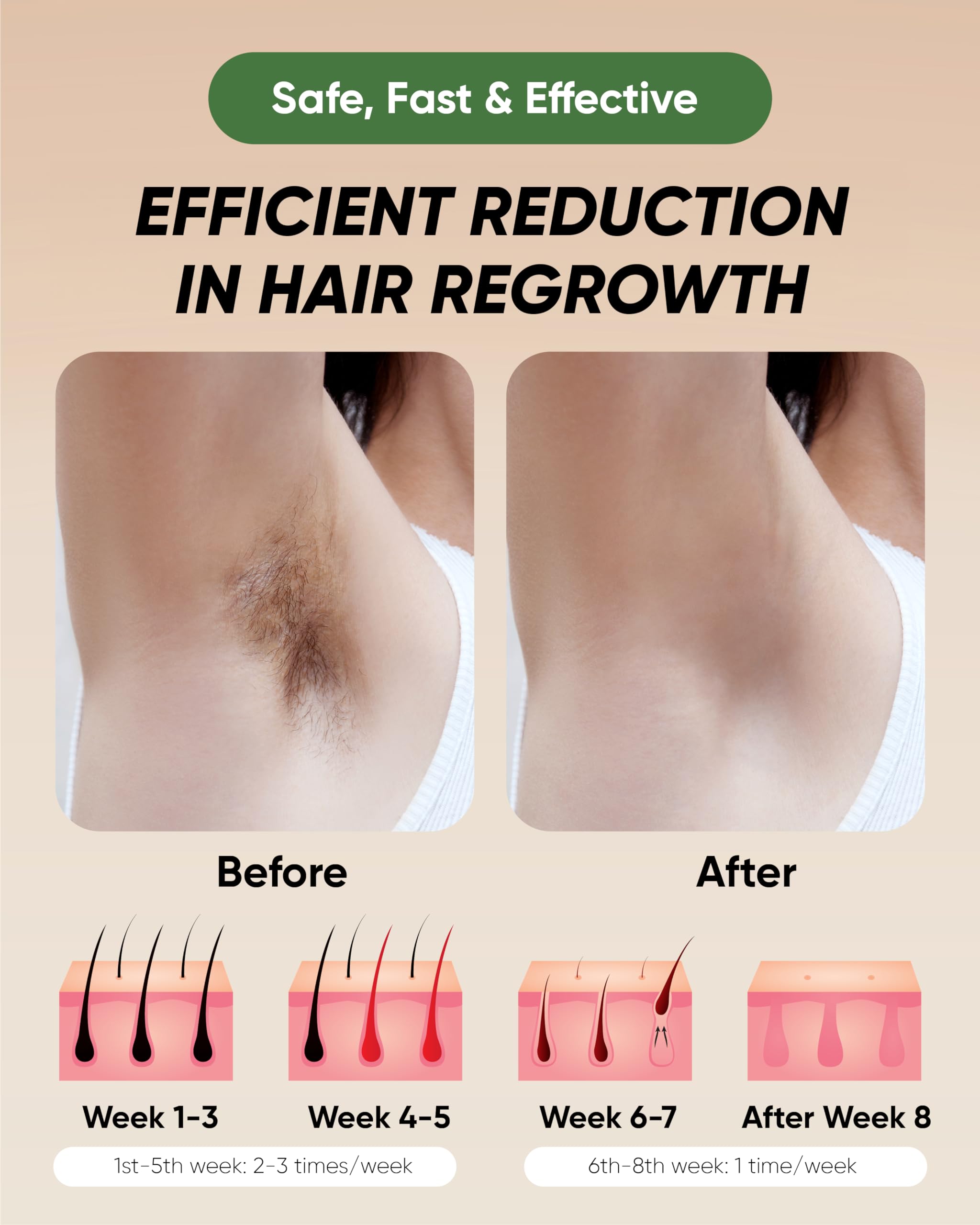 Manufacturer Machine Portable Electric Laser Body Hair Remover Professional Ipl Hair Removal Home Use Device