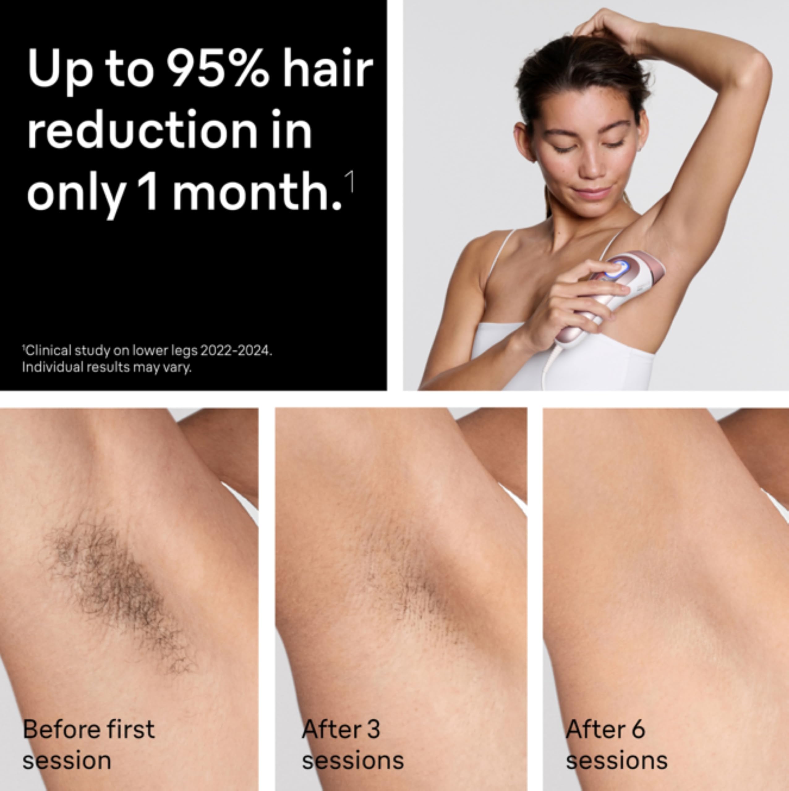 Lumora IPL Pro – Permanent Hair Reduction at Home