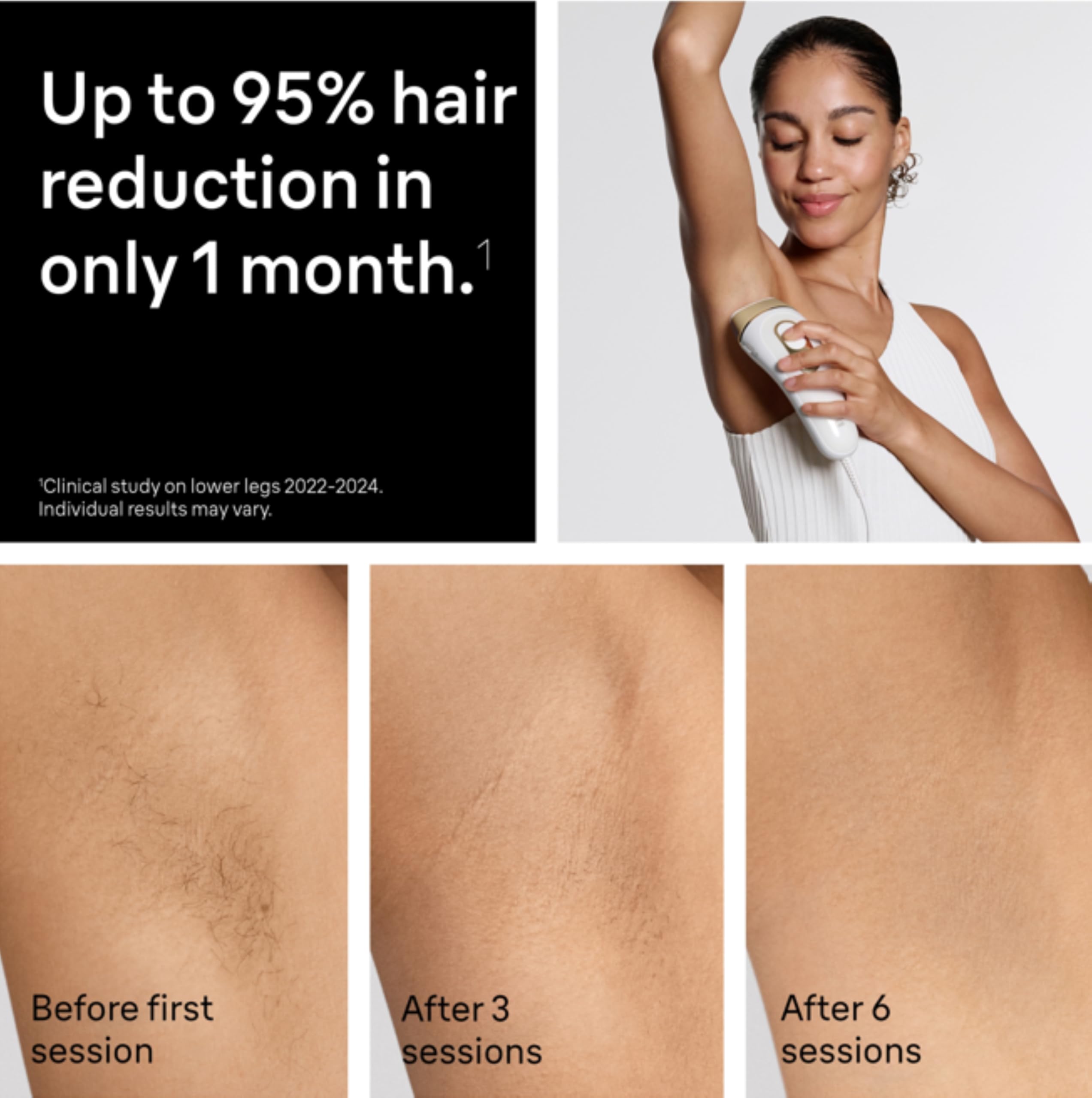 Lumora IPL Pro 5 – Long-Lasting Hair Removal at Home