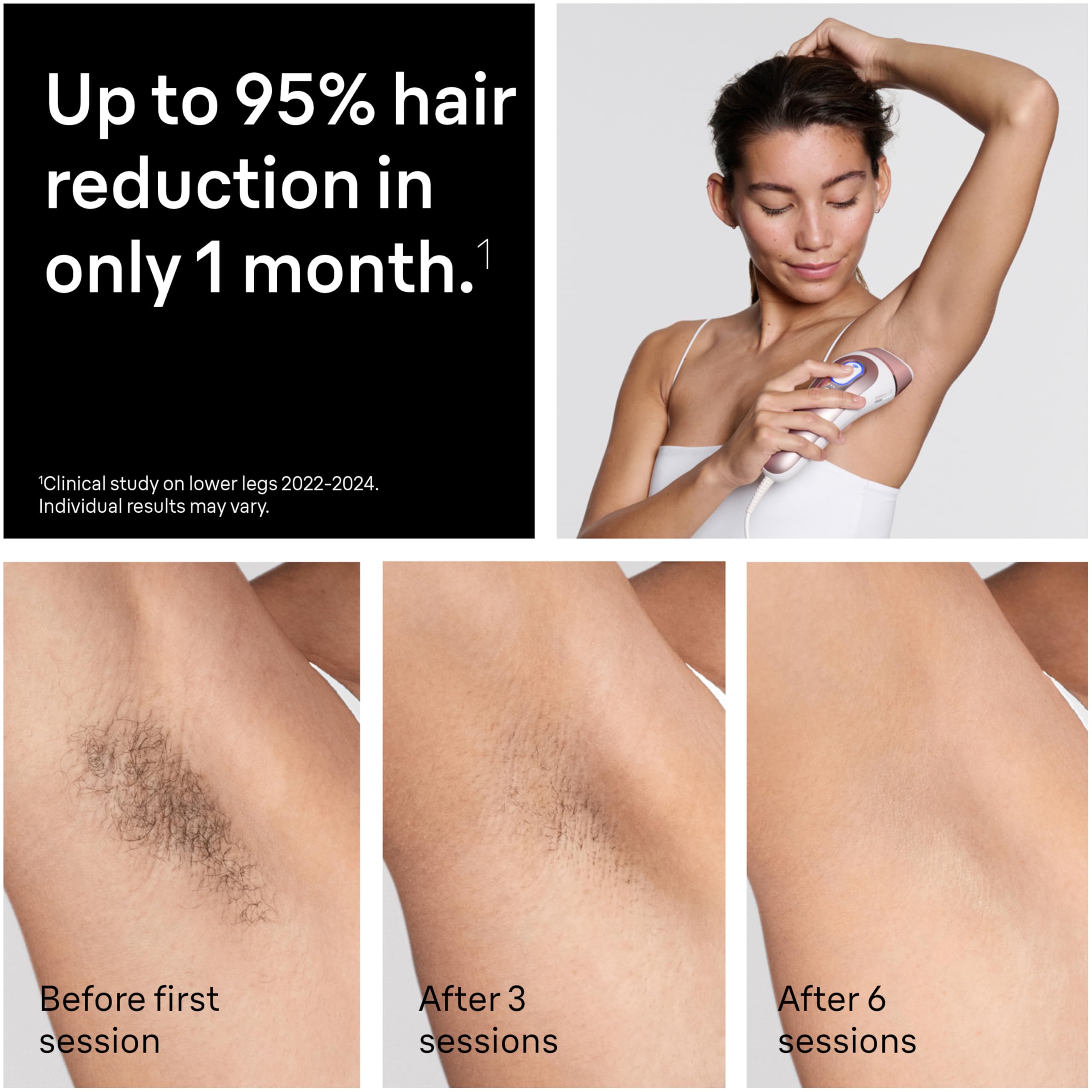 Lumora IPL Pro – Permanent Hair Reduction at Home